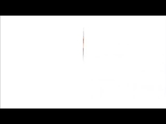 Термопринтер рентгеновского излучения