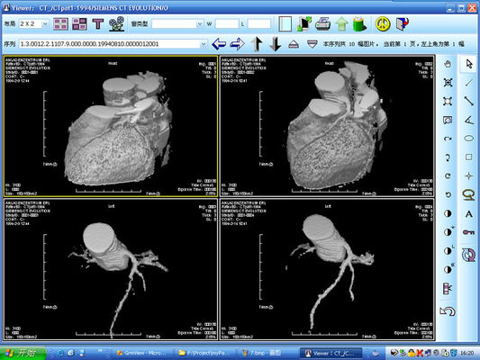 Хорошая цена Галоид диагностического воображения лазерного принтера кс Рэй серебряный на КНД-ДРИТЭК 4000 онлайн
