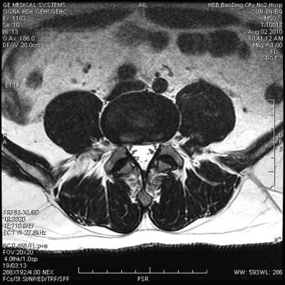 Хорошая цена Фильм воображения низкого тумана КНД-А медицинский сухой для рассмотрения кс Рэй на × 14ин АГФА 5300 11ин онлайн
