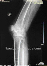 Хорошая цена Прочное воображение кс Рэй диагностическое, фильм кс Рэй лазера медицинской бумаги 32км кс 43км голубой онлайн