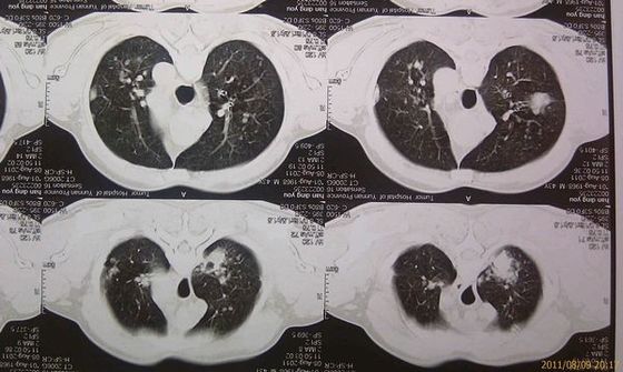 Хорошая цена Дружественный к Эко медицинский сухой фильм Агфа 2Б кс Рэй с машиной КТ онлайн