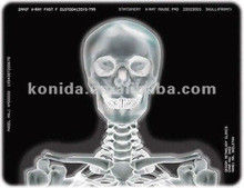 Хорошая цена Медицинская пленка для термопринтера рентгеновского излучения KND-F25*30 см онлайн