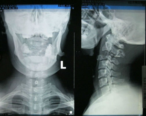 Хорошая цена Бумага рентгеновского снимка медицинского отображения Конида высокой сметливости пригодная для носки для лазерного принтера онлайн