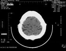 Хорошая цена 8 кс 10 Царапина-устойчивых медицинских бумажных фильмов рентгеновского снимка для лазерных принтеров Конида онлайн