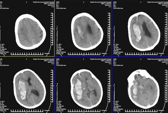 Хорошая цена Водоустойчивый медицинский кс Рэй диагностическое отображая КНД-К для лазерного принтера Конида онлайн