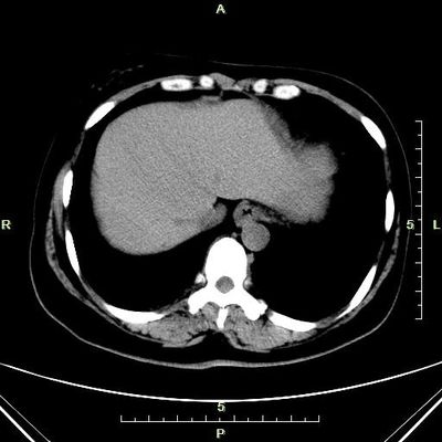 Хорошая цена Тонкая бумага лазера Конида кс Рэй диагностическая отображая голубая для машины рентгеновского снимка онлайн