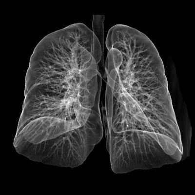 Хорошая цена Фильм Фудзи медицинский сухой онлайн