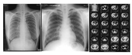 Хорошая цена тон фильма термального принтера 14 кс 17 дюймов яркий с двойным слоем онлайн