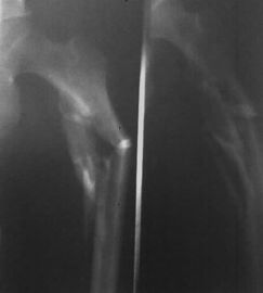 Хорошая цена 11 фильм рентгеновского снимка цифров кс 14инч медицинский для принтера АГФА/Фудзи онлайн