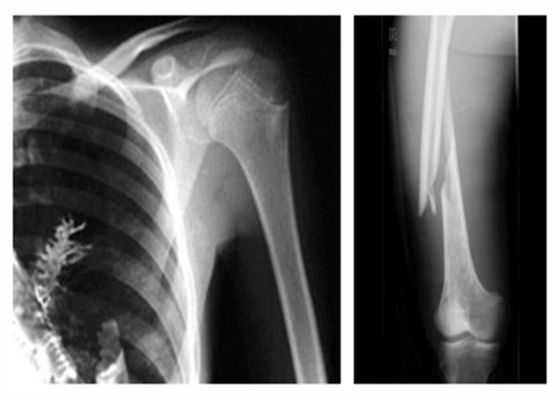 Хорошая цена Высокоскоростной фильм термального принтера, Агфа Дт2б 8 кс 10 дюймов/кс 10 кс 12 дюймов/14 17инч онлайн