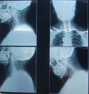 Хорошая цена Медицинский бумажный сухой фильм КНД-К воображения для лазерного принтера КНД-ДРИТЭК-3000 Конида/4000 онлайн