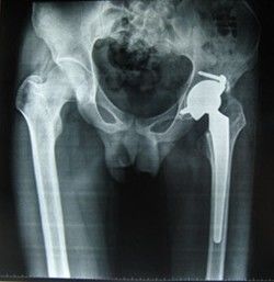 Хорошая цена Фильм 28км * 35км воображения Конида низкого основания полиэстера тумана сизоватого медицинский сухой для термального принтера онлайн