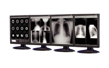 Анти--отражательные дисплеи медицинской ранга используемые в оборудовании медицинского отображения