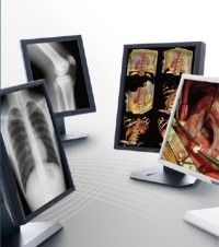 Good price Ясные дисплеи медицинской ранга изображения, дисплей серого масштаба 5МП медицинский онлайн