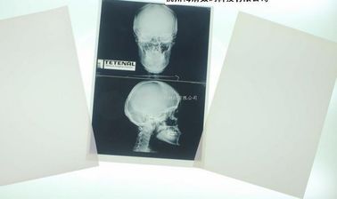 Фильм Деградабле белой низкопробной бумаги рентгеновского снимка медицинский для лазерного принтера