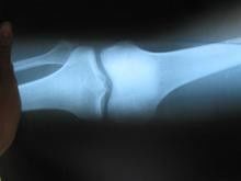 Царапина-устойчивая бумага рентгеновского снимка фильма 25км * 30км медицинская для лазерного принтера Конида