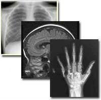 Царапина-устойчивая бумага рентгеновского снимка фильма 25км * 30км медицинская для лазерного принтера Конида
