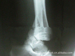 Бумага рентгеновского снимка медицинского отображения Конида высокой сметливости пригодная для носки для лазерного принтера