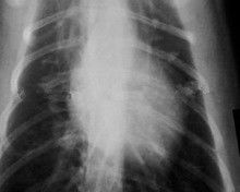 Низкий туман 11 кс бумажный фильм рентгеновского снимка 14 для медицинских лазерных принтеров КНД-К
