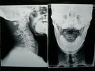 Рентгеновский снимок цифров фильма воображения Конида медицинский сухой для принтеров Фудзи/Агфа