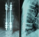 Сделайте медицинского ЛЮБИМЦА водостойким бумаги рентгеновского снимка, фильма для лазерного принтера Конида, радиографического бумажного фильма