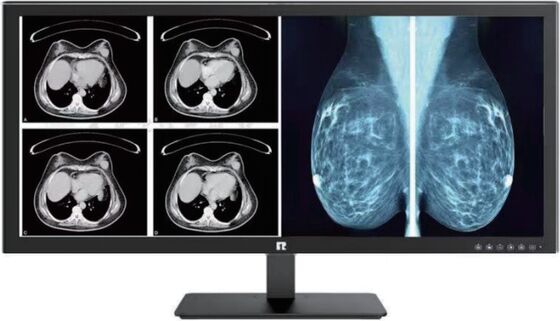 Хорошая цена High Definition Medical Display For Precision Medical Imaging And Healthcare Monitoring онлайн