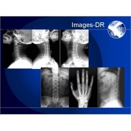 Машина рентгенографирования цифров РЕНТГЕНОВСКОГО СНИМКА Маммогрпахы с гибкой рукой УК