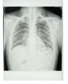 Таможня фильм бумаги рентгеновского снимка основания белизны 25км * 30км медицинский с материалами ЛЮБИМЦА