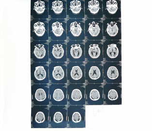 Медицинское бумажное воображение лазерного принтера кс Рэй диагностическое для больницы