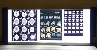 фильмы медицинского отображения рентгеновского снимка 10ин * 14ин цифров сухие для термальных принтеров КНД-Ф