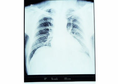 восходящий поток теплого воздуха фильма 10 x 14 рентгеновских снимков медицинский сухой отображая чувствительный для принтера Фудзи