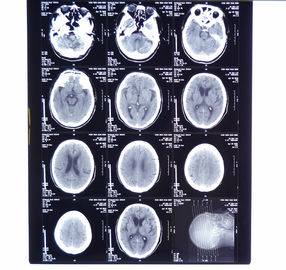 Фильм рентгеновского снимка Конида больницы ясный медицинский с термальными принтерами