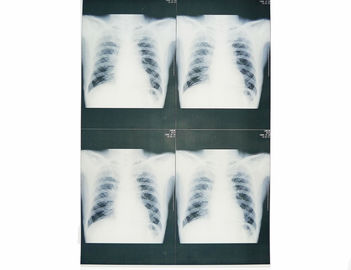 Пригодные для носки белые низкопробные медицинские фильмы кс Рэй, фильм бумаги рентгеновского снимка медицинского отображения