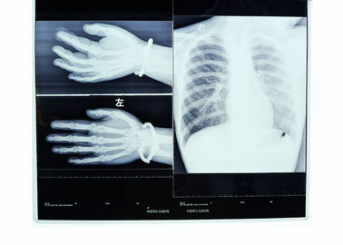 Низкий туман фильм термального принтера прозрачности рентгеновского снимка медицинского отображения 14ин * 17ин сухой