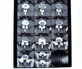 8ин* 10ин фильм термального принтера хигх-денситы медицинского рентгеновского снимка 14ин * 17ин сухой