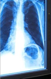 Фильм 11ин кс 17ин медицинского отображения голубого рентгеновского снимка сухой для термального принтера