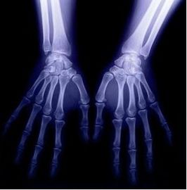 Воображение цифров медицинское диагностическое, фильм рентгеновского снимка 8 кс 10 КТ сухой